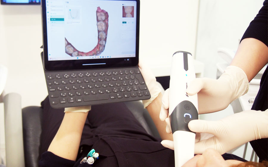 口腔内スキャナー